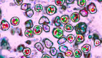 measles-1-gty-er-260120_1768925917623_hpMain_3_16x9