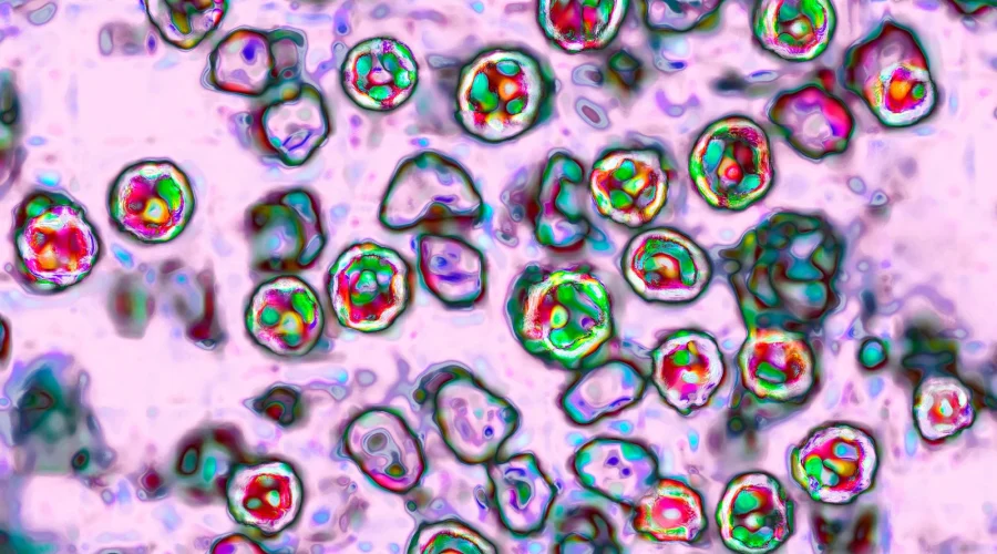 measles-1-gty-er-260120_1768925917623_hpMain_3_16x9